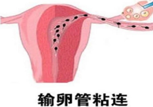 避免宝宝患有唐氏疾病孕期唐氏筛查不可忽视