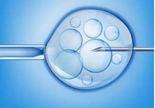 绍兴助孕：俄罗斯供卵试管婴儿双胞胎价格受多方面因素影响，年龄越大费用越高