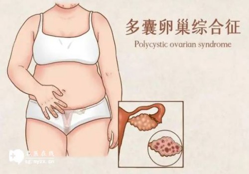 绍兴助孕：睾丸片是激素药，这些人群都不宜使用